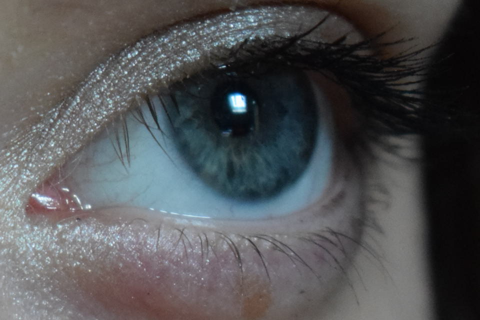 oeil
